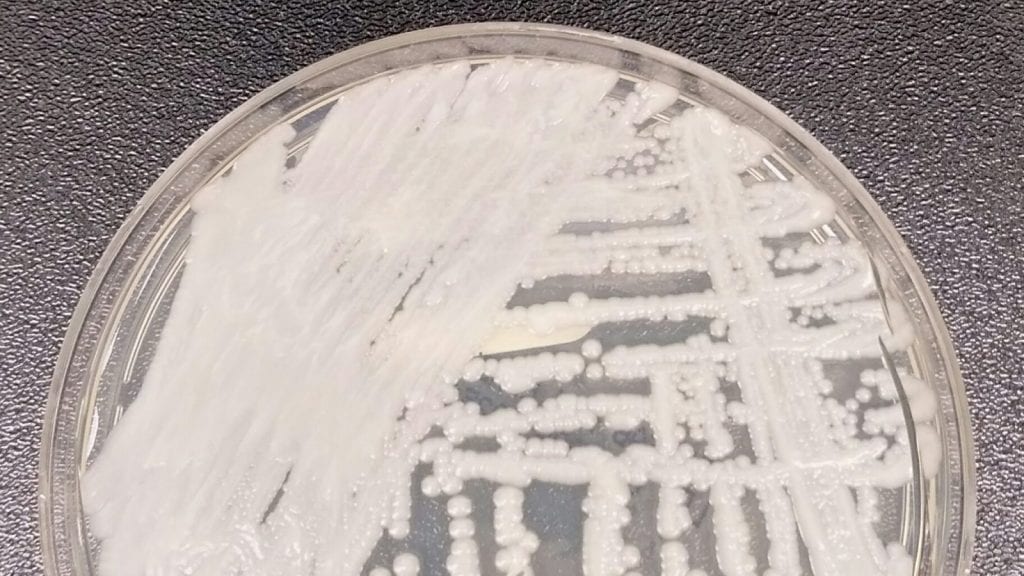 CDC Continues To Warn Of Threat Posed By Deadly Fungus Which Thrives In   Candida Auris 2016 1600x900 1024x576 