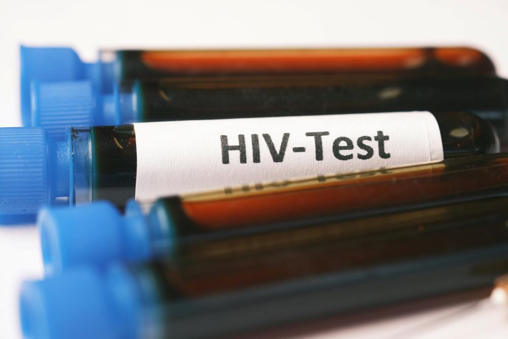 An Aging HIV Population is Exposing Important System Flaws