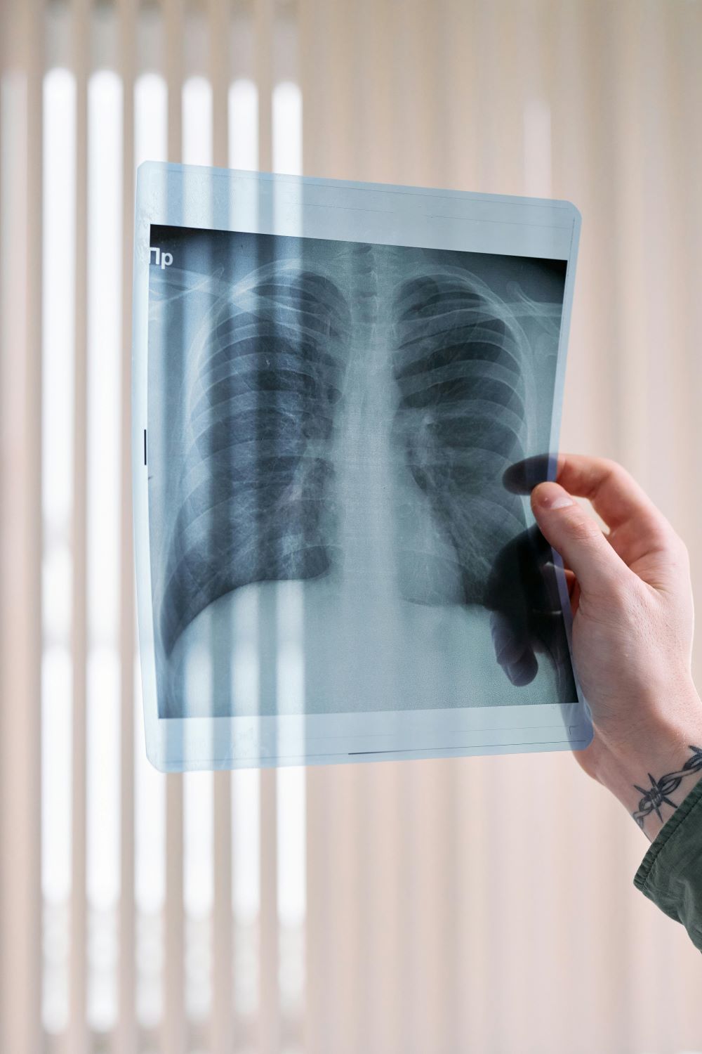 New Scanning Method Closely Tracks Lung Functioning