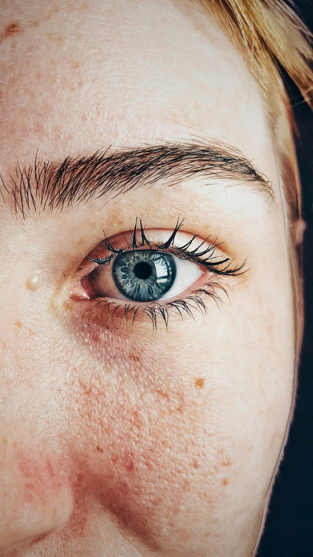 Common Asthma Drug May Help Retina in Aging Eyes